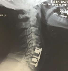 MRI